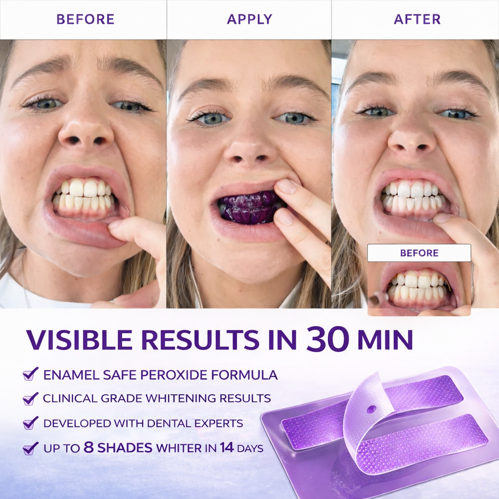 Teeth Whitening Strips (14 Strips Pack)